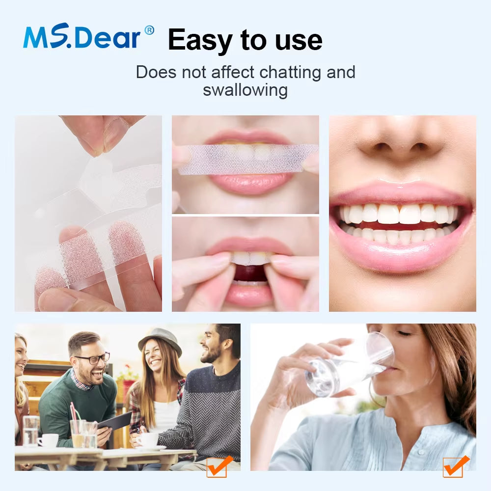 White Teeth Cleaning Strips 